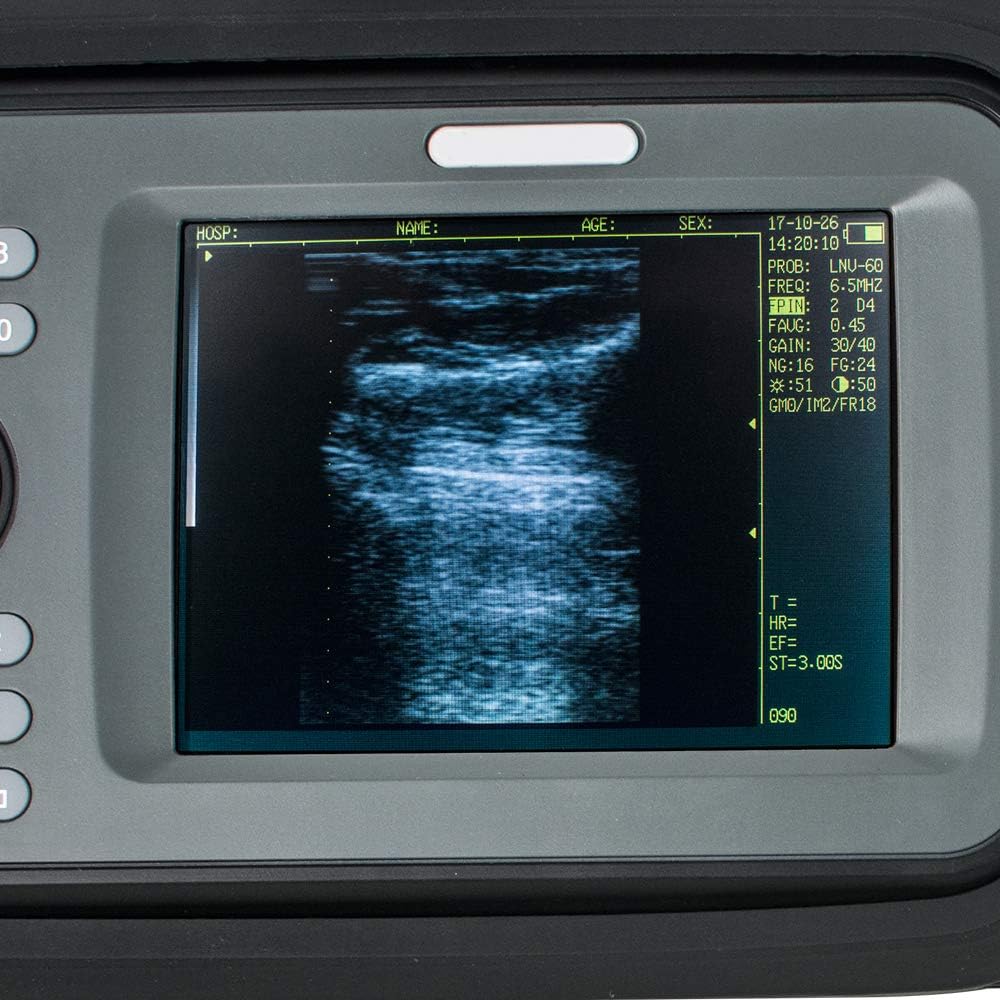 Portable Handheld Scanner Veterinary Digital Machine with 6.5MHz Rectal Handle S66970